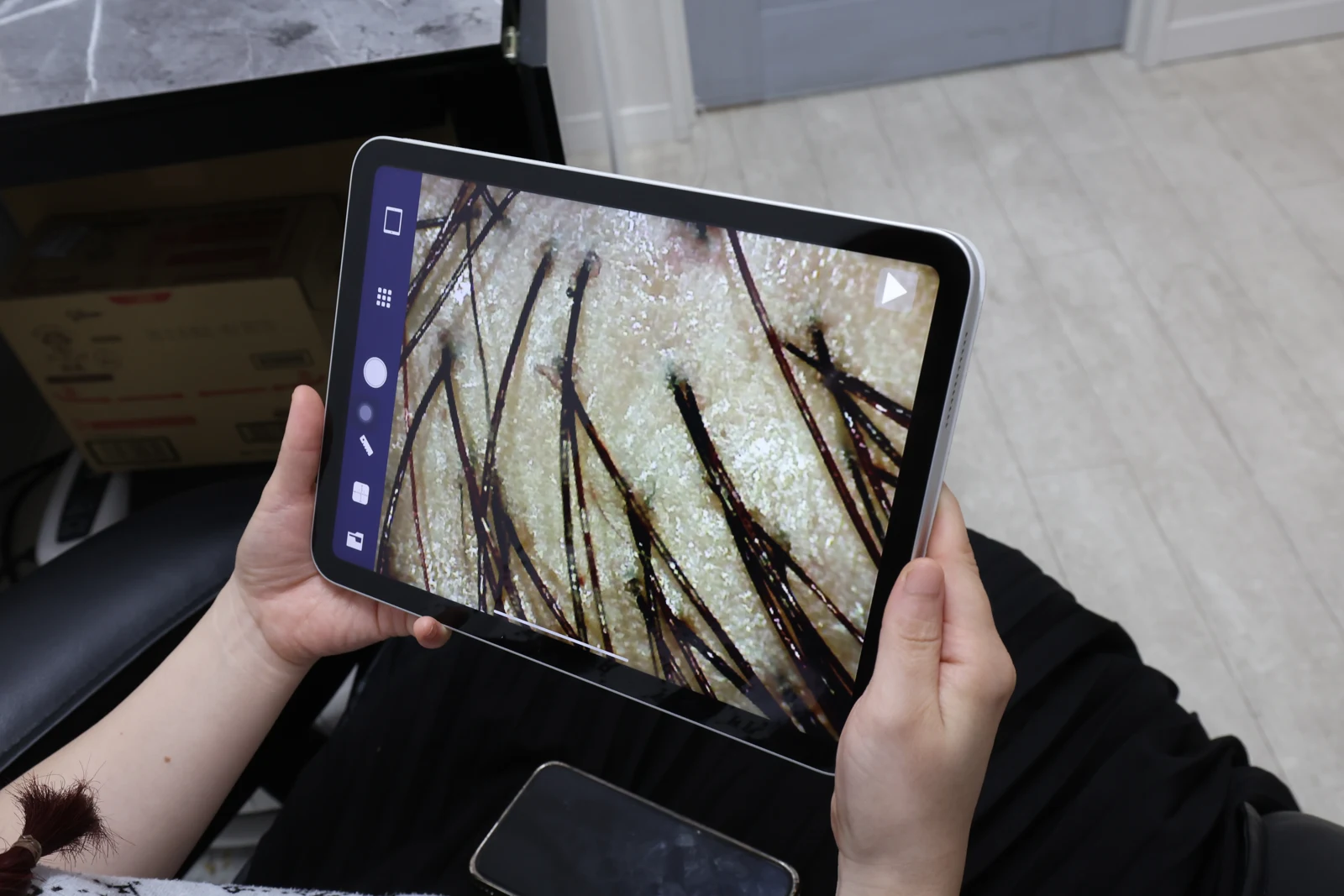 タブレットで頭皮の拡大映像を一緒に確認する様子